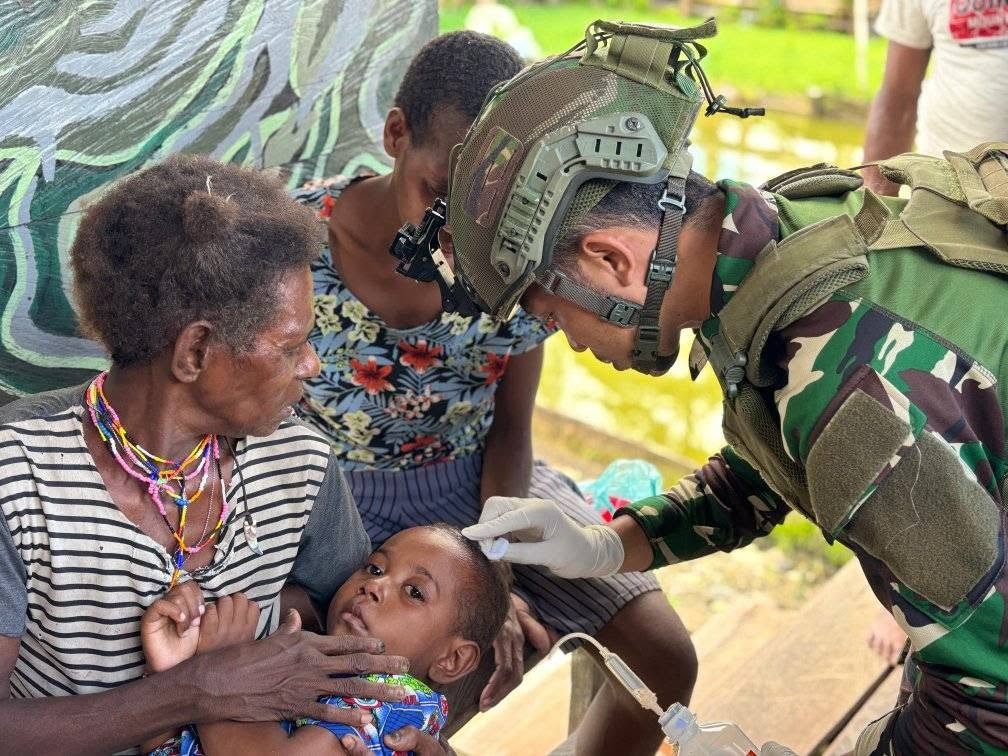 KESIGAPAN TNI DI PAPUA: LUKA KEPALA BALITA SEGERA TERTANGANI OLEH SATGAS YONIF 733/MASARIKU